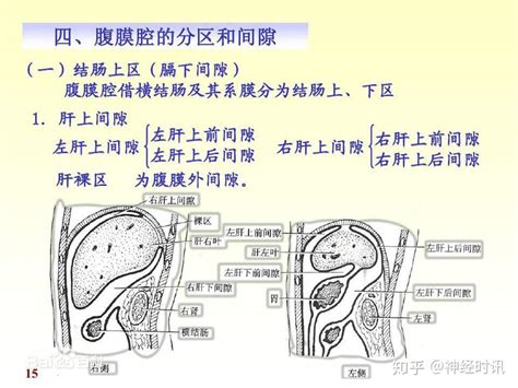 剖腹位置